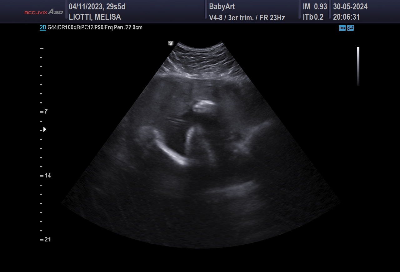 JULIA DE MELISA LIOTTI_0063.JPG